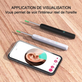 Nettoyeur d'Oreilles Intelligent HD